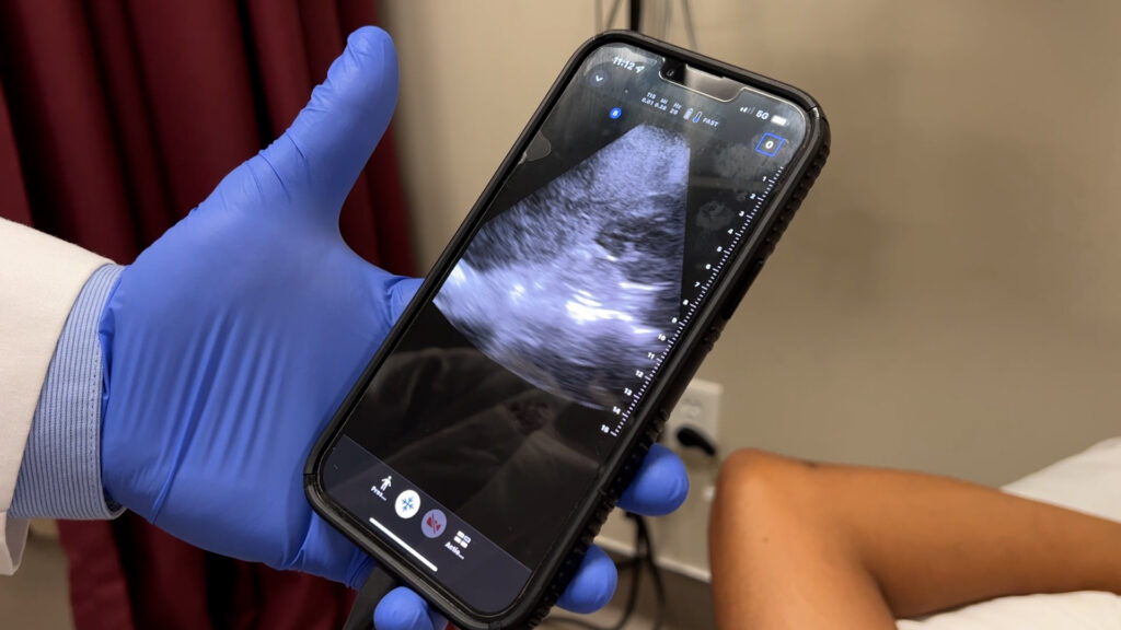 Ultrasound on a cell phone